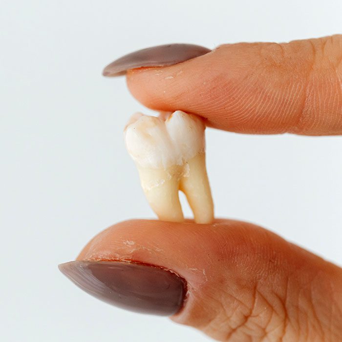 - Z Dental Care