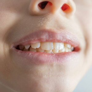 - Z Dental Care