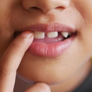 pediatric dentistry portage park